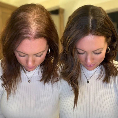 Dermaevra™ Hair Growth Serum