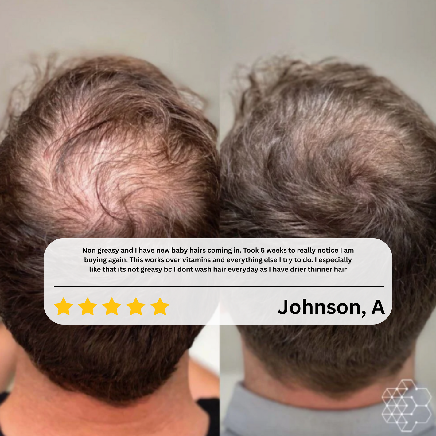 Dermaevra™ Hair Growth Serum